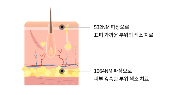 인라이튼 피코토닝 안내 이미지