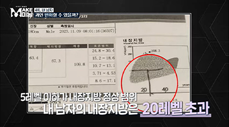 부위별 지방흡입 안내 이미지