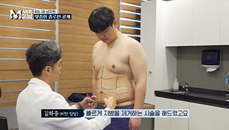 부위별 지방흡입 안내 이미지