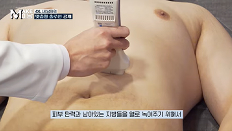 부위별 지방흡입 안내 이미지