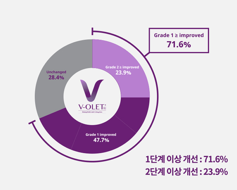 브이올렛 주사 안내 이미지