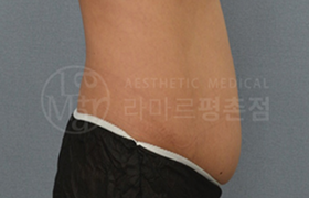 라마르 슬림컷 전